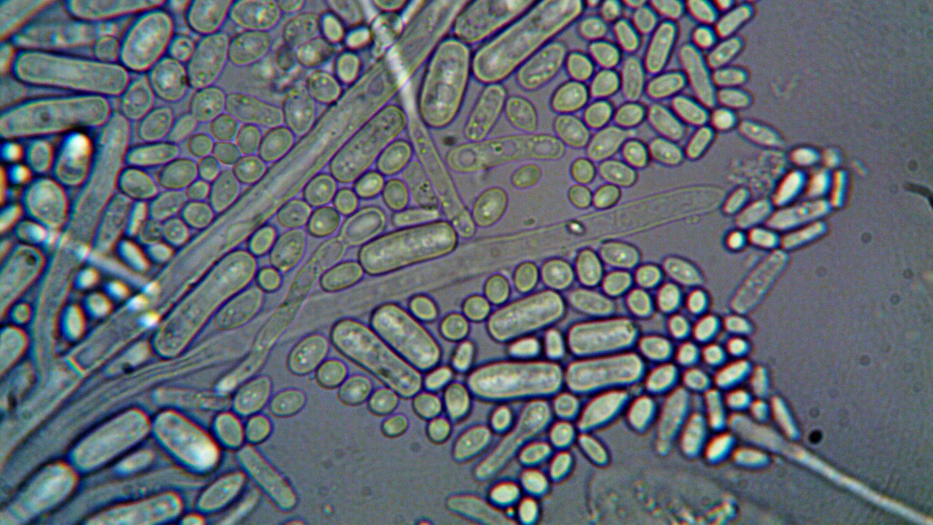 A close-up view of microorganisms, also known as microbes.