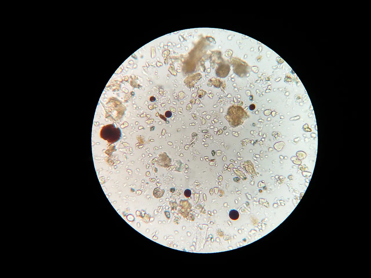 Close-up view of soil microbes as seen under a microscope.