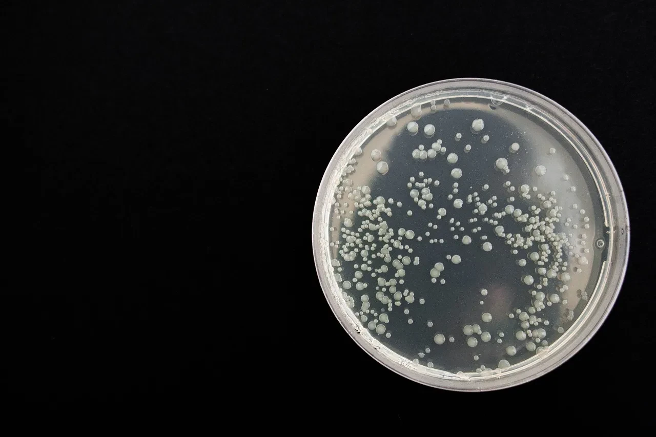 Petri dish containing soil microorganisms.